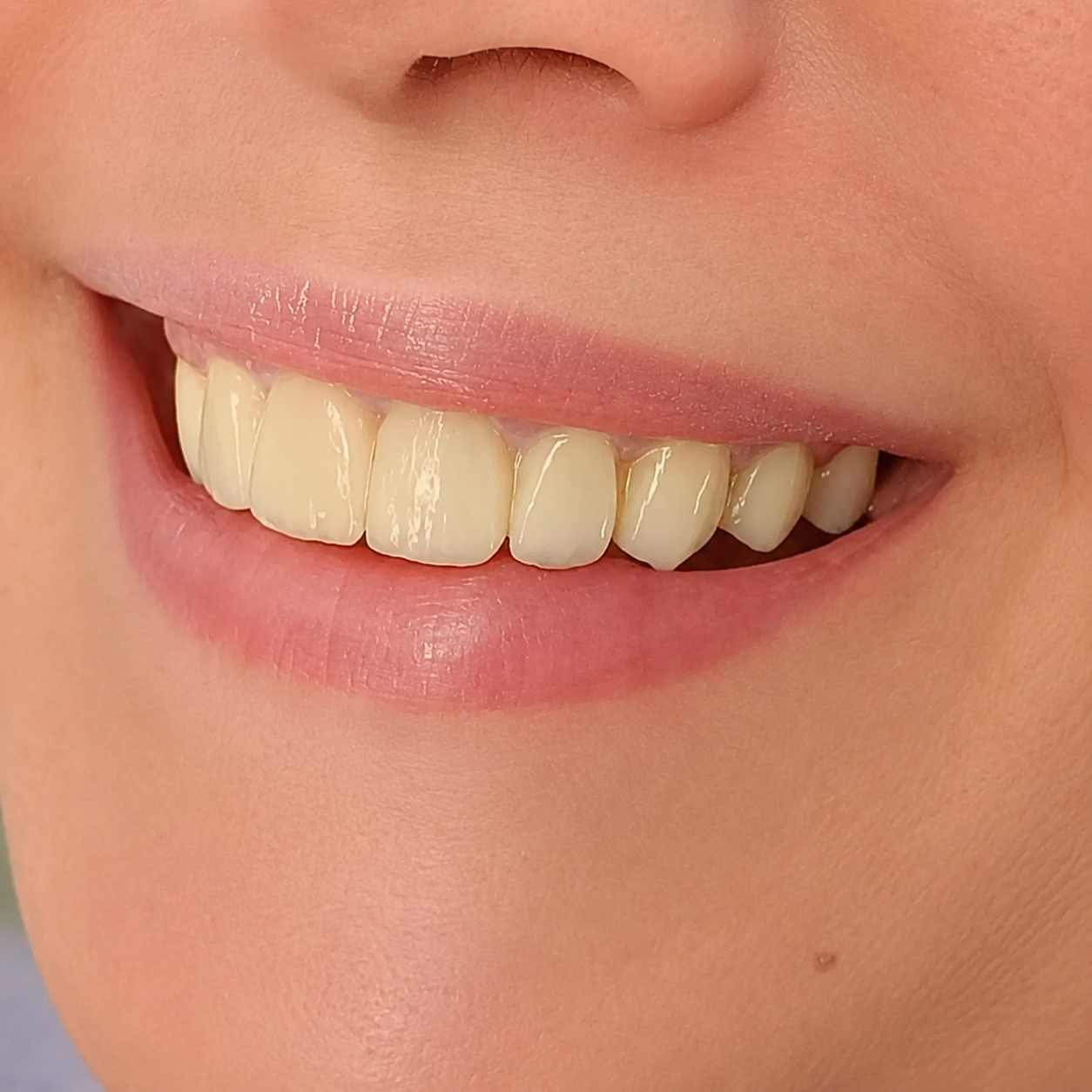 Dentiste kenitra Dr hafsa cabinet dentaire